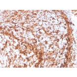 Immunohistochemistry - Anti-Vimentin Antibody [VIM/4388R] (A250315) - Antibodies.com