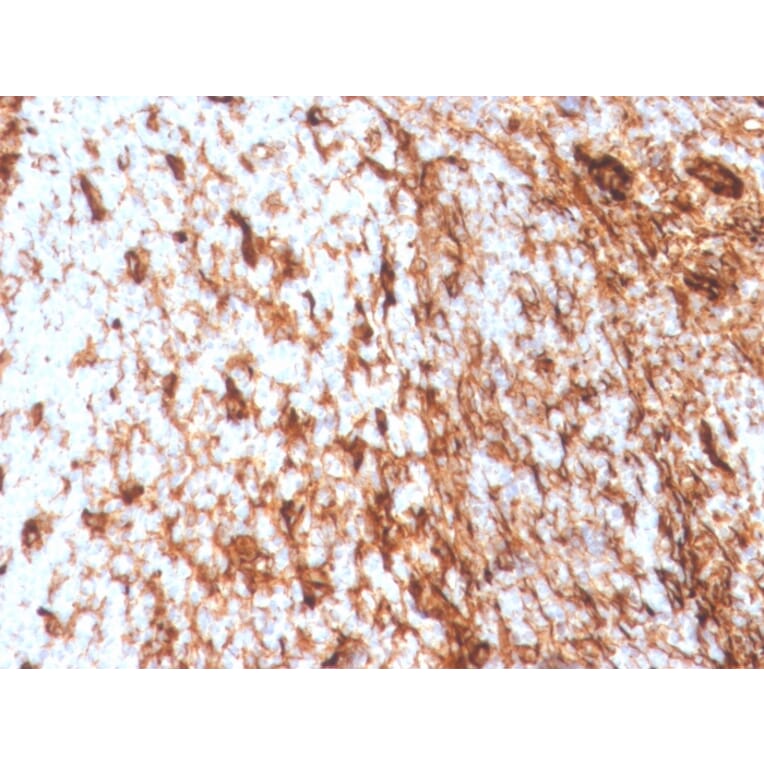 Immunohistochemistry - Anti-Vimentin Antibody [VIM/4388R] (A253491) - Antibodies.com