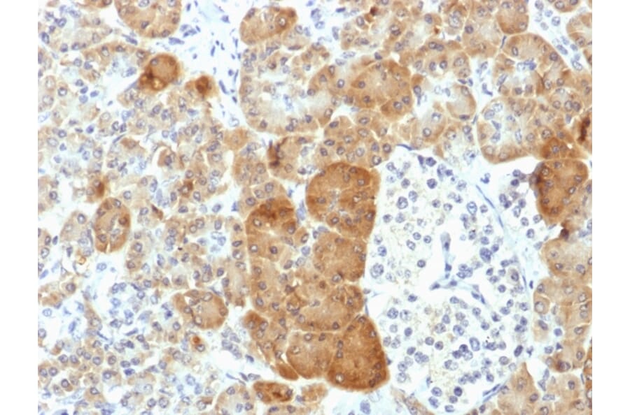 Immunohistochemistry - Anti-VLDL Receptor Antibody [VLDLR/1337] (A250315) - Antibodies.com