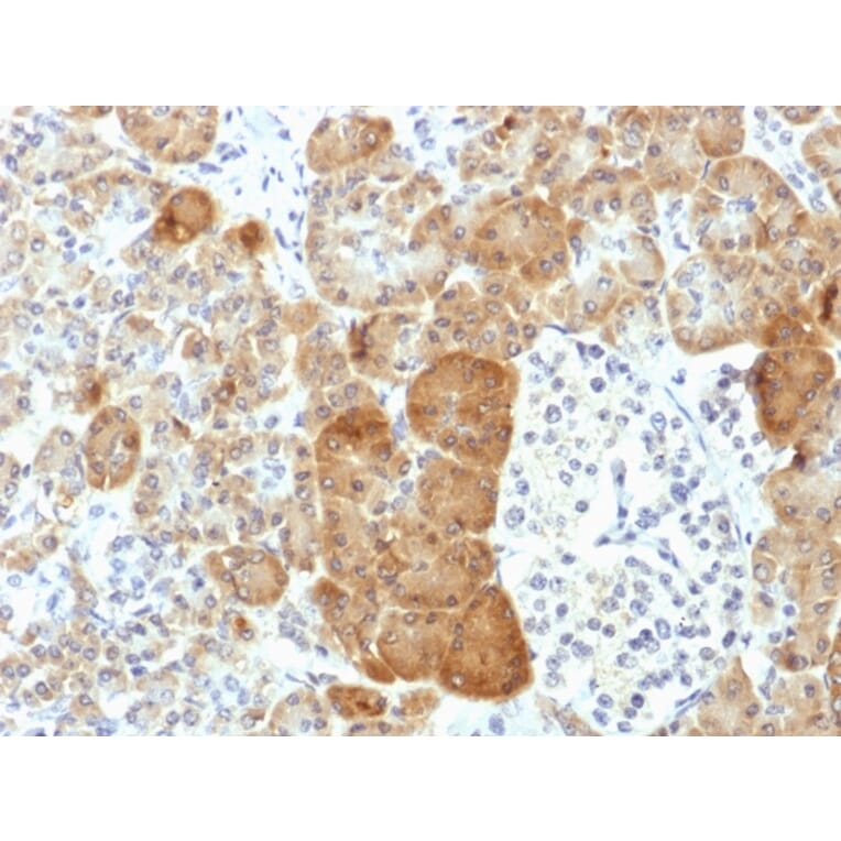 Immunohistochemistry - Anti-VLDL Receptor Antibody [VLDLR/1337] (A250315) - Antibodies.com