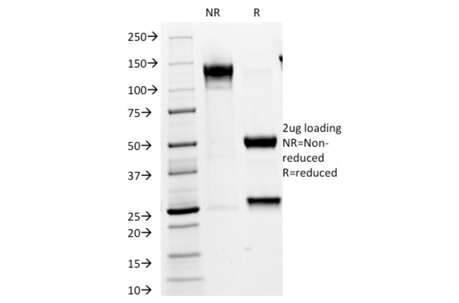 SDS-PAGE - Anti-VLDL Receptor Antibody [VLDLR/1337] (A250316) - Antibodies.com