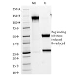 SDS-PAGE - Anti-VLDL Receptor Antibody [VLDLR/1337] (A250316) - Antibodies.com