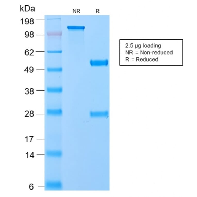 SDS-PAGE - Anti-VLDL Receptor Antibody [VLDLR/2896R] (A250316) - Antibodies.com