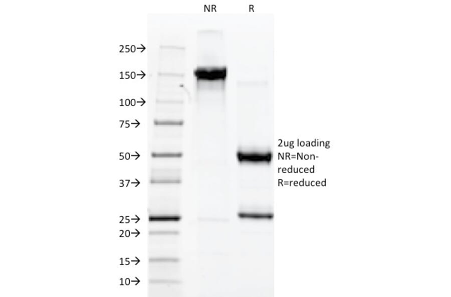 SDS-PAGE - Anti-Von Willebrand Factor Antibody [3E2D10] (A250320) - Antibodies.com