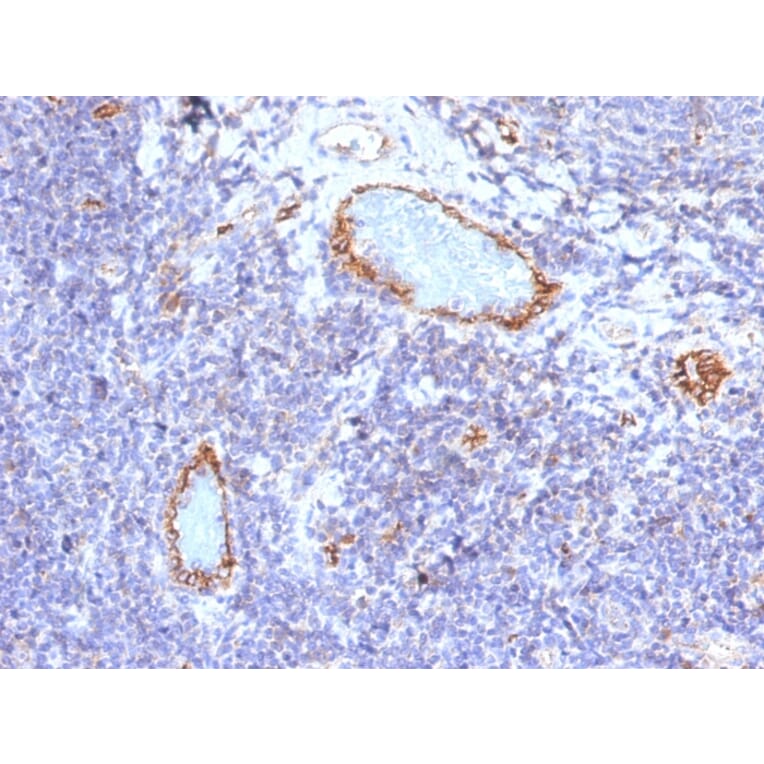 Immunohistochemistry - Anti-Von Willebrand Factor Antibody [VWF/1465] (A250325) - Antibodies.com