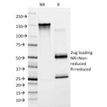 SDS-PAGE - Anti-Von Willebrand Factor Antibody [F8/86] (A250326) - Antibodies.com