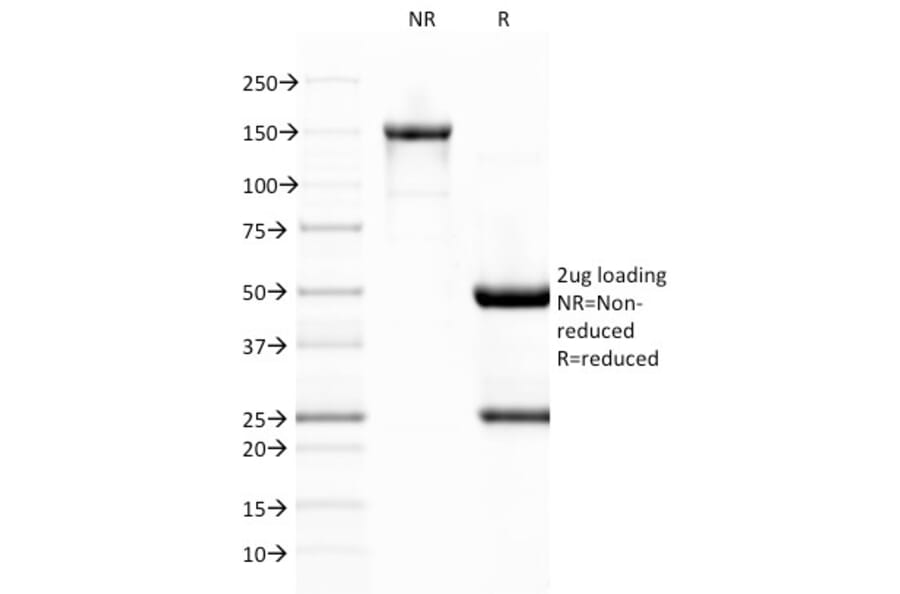 SDS-PAGE - Anti-Von Willebrand Factor Antibody [VWF/1767] (A250327) - Antibodies.com