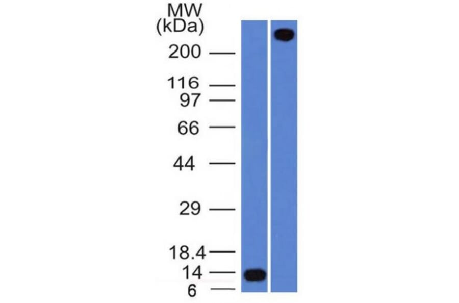 Western Blot - Anti-Von Willebrand Factor Antibody [rVWF/1465] (A250328) - Antibodies.com