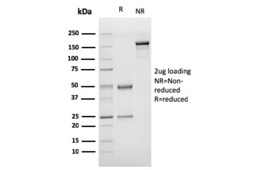 SDS-PAGE - Anti-Von Willebrand Factor Antibody [rVWF/1465] (A250328) - Antibodies.com