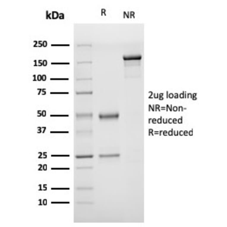 SDS-PAGE - Anti-Von Willebrand Factor Antibody [rVWF/1465] (A250328) - Antibodies.com