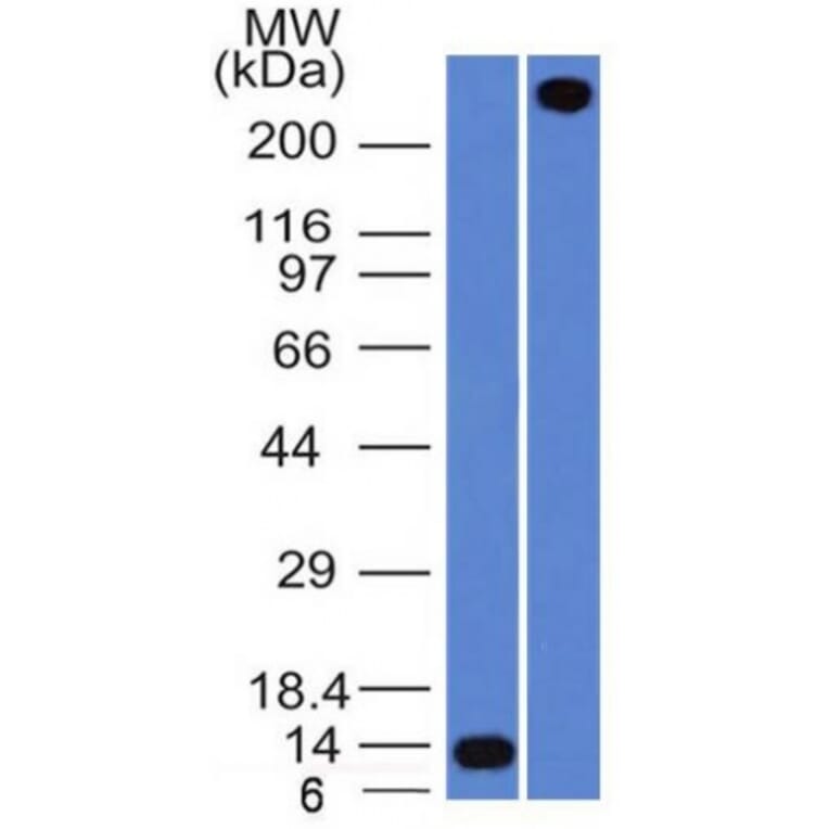 Western Blot - Anti-Von Willebrand Factor Antibody [VWF/1859R] (A250329) - Antibodies.com