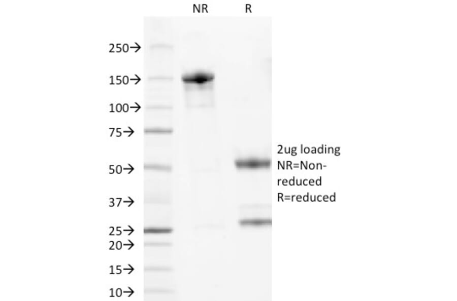 SDS-PAGE - Anti-Wilms Tumor Protein Antibody [6F-H2] (A250330) - Antibodies.com