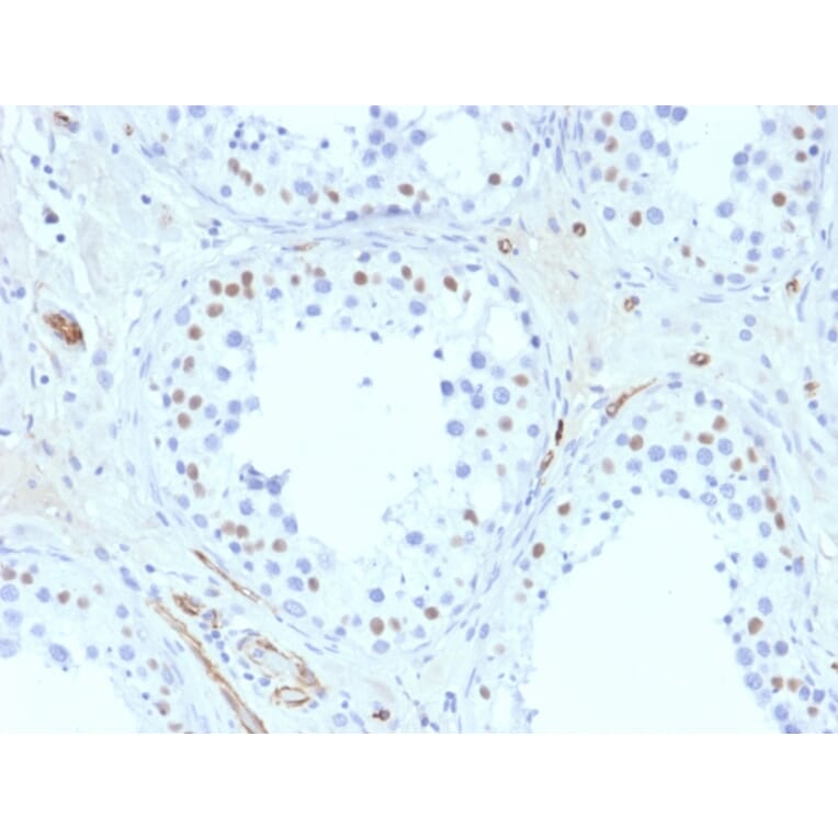 Immunohistochemistry - Anti-Wilms Tumor Protein Antibody [6F-H2] (A250330) - Antibodies.com