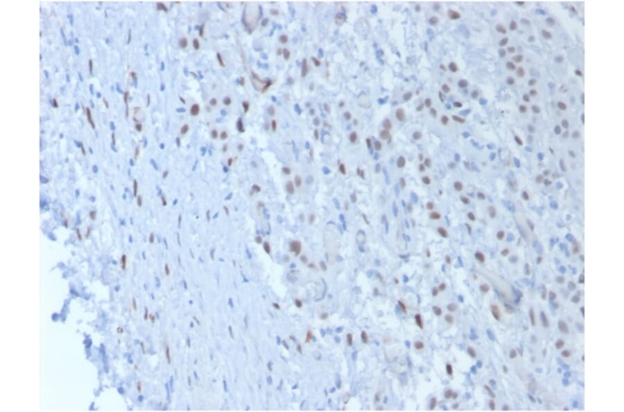 Immunohistochemistry - Anti-Wilms Tumor Protein Antibody [SPM361] (A250330) - Antibodies.com