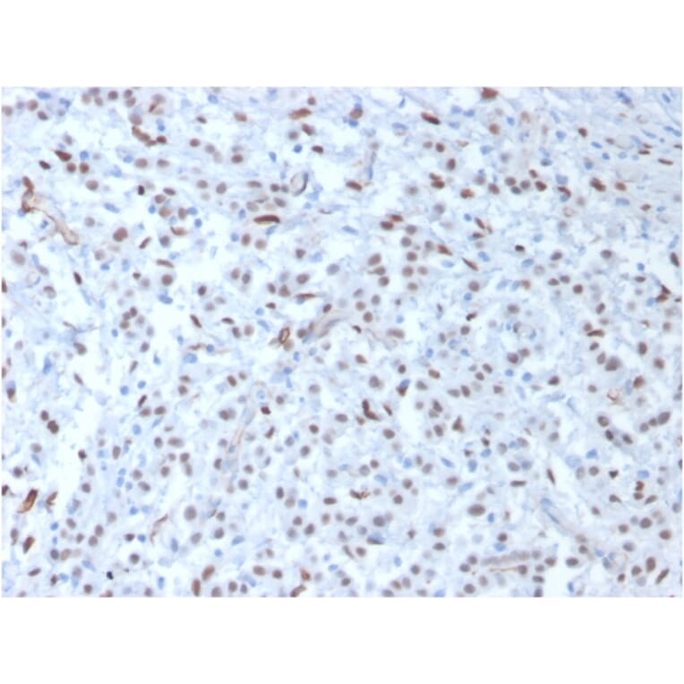 Immunohistochemistry - Anti-Wilms Tumor Protein Antibody [WT1/857] (A250331) - Antibodies.com