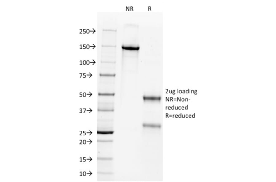 SDS-PAGE - Anti-Wilms Tumor Protein Antibody [WT1/857] (A250332) - Antibodies.com