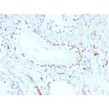 Immunohistochemistry - Anti-Wilms Tumor Protein Antibody [WT1/857] (A250332) - Antibodies.com