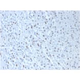 Immunohistochemistry - Anti-Wilms Tumor Protein Antibody [WT1/857 + 6F-H2] (A250332) - Antibodies.com