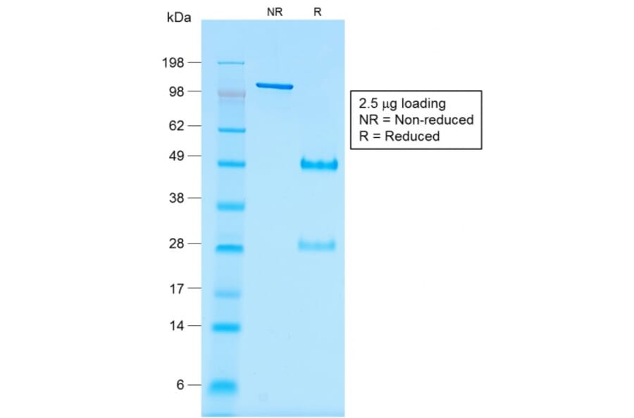SDS-PAGE - Anti-Wilms Tumor Protein Antibody [rWT1/857] (A250334) - Antibodies.com