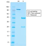 SDS-PAGE - Anti-Wilms Tumor Protein Antibody [rWT1/857] (A250334) - Antibodies.com