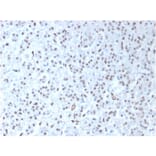 Immunohistochemistry - Anti-Wilms Tumor Protein Antibody [WT1/1434R] (A250334) - Antibodies.com