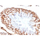 Immunohistochemistry - Anti-Wilms Tumor Protein Antibody [WT1/1434R] (A250335) - Antibodies.com