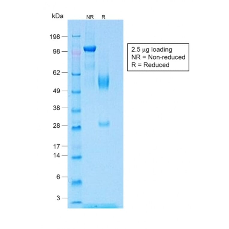 SDS-PAGE - Anti-Wilms Tumor Protein Antibody [WT1/1434R] (A250335) - Antibodies.com