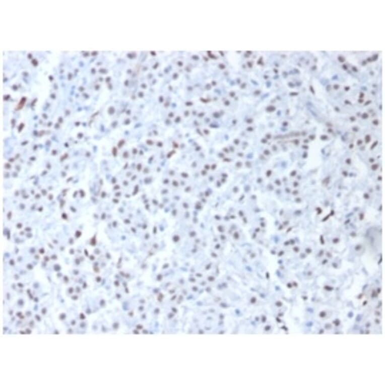 Immunohistochemistry - Anti-Wilms Tumor Protein Antibody (A250336) - Antibodies.com