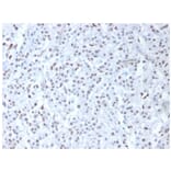 Immunohistochemistry - Anti-Wilms Tumor Protein Antibody (A250336) - Antibodies.com