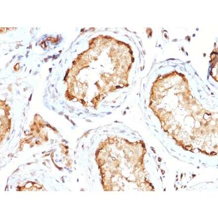 Immunohistochemistry - Anti-14-3-3E Antibody [CPTC-YWHAE-1] (A250339) - Antibodies.com