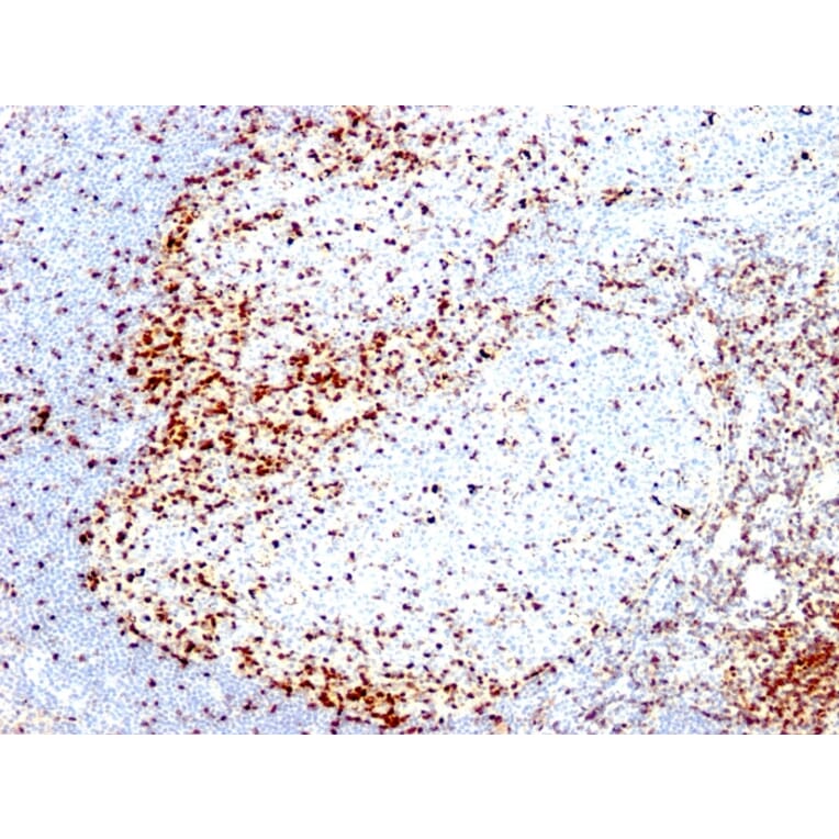 Immunohistochemistry - Anti-ZAP70 Antibody [2F3.2] (A250340) - Antibodies.com