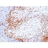 Immunohistochemistry - Anti-ZAP70 Antibody [2F3.2] (A250340) - Antibodies.com