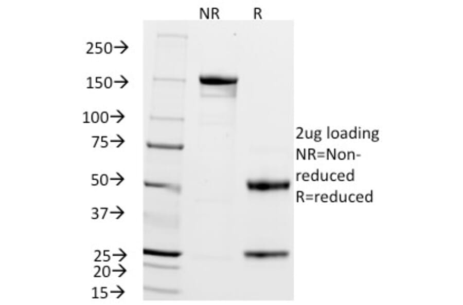 SDS-PAGE - Anti-ZAP70 Antibody [2F3.2] (A250340) - Antibodies.com