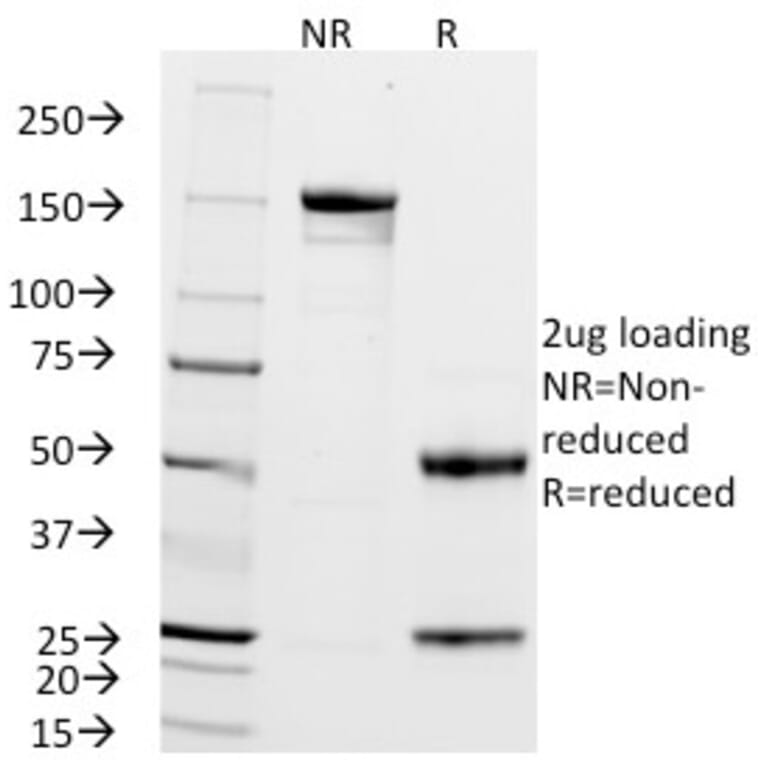 SDS-PAGE - Anti-ZAP70 Antibody [2F3.2] (A250340) - Antibodies.com