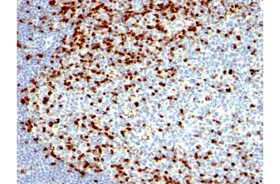 Immunohistochemistry - Anti-ZAP70 Antibody [SPM362] (A250340) - Antibodies.com