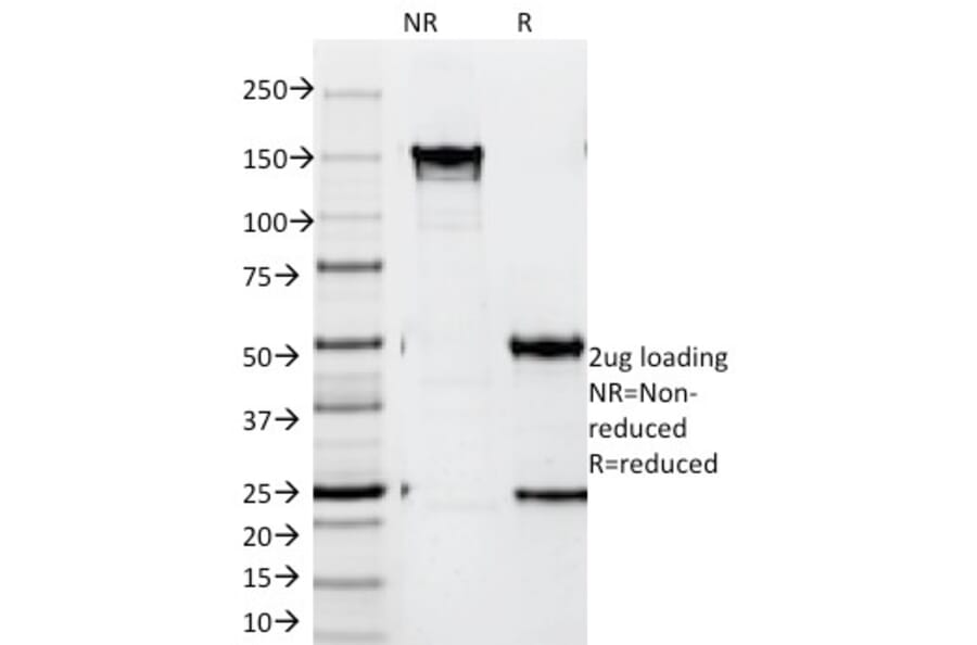 SDS-PAGE - Anti-ZAP70 Antibody [SPM362] (A250341) - Antibodies.com