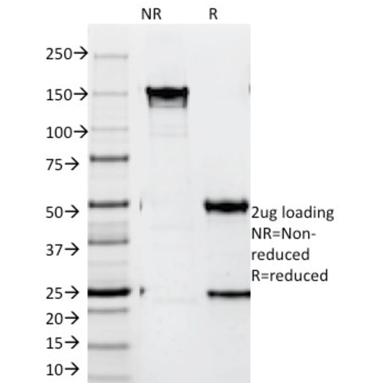 SDS-PAGE - Anti-ZAP70 Antibody [SPM362] (A250341) - Antibodies.com