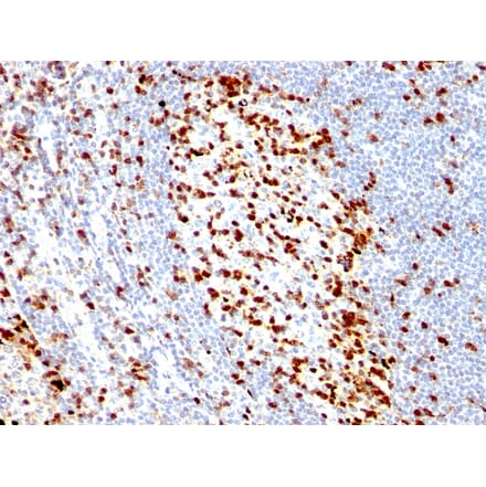 Immunohistochemistry - Anti-ZAP70 Antibody [ZAP70/528] (A250341) - Antibodies.com