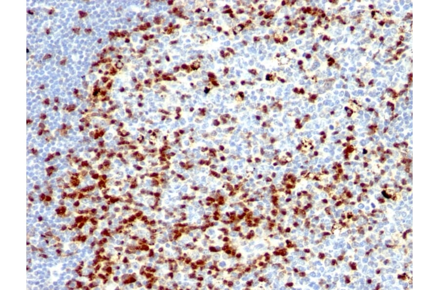 Immunohistochemistry - Anti-ZAP70 Antibody [ZAP70/528 + 2F3.2] (A250342) - Antibodies.com