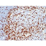 Immunohistochemistry - Anti-ZAP70 Antibody [ZAP70/528 + 2F3.2] (A250342) - Antibodies.com