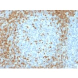 Immunohistochemistry - Anti-ZAP70 Antibody [ZAP70/2035] (A250344) - Antibodies.com