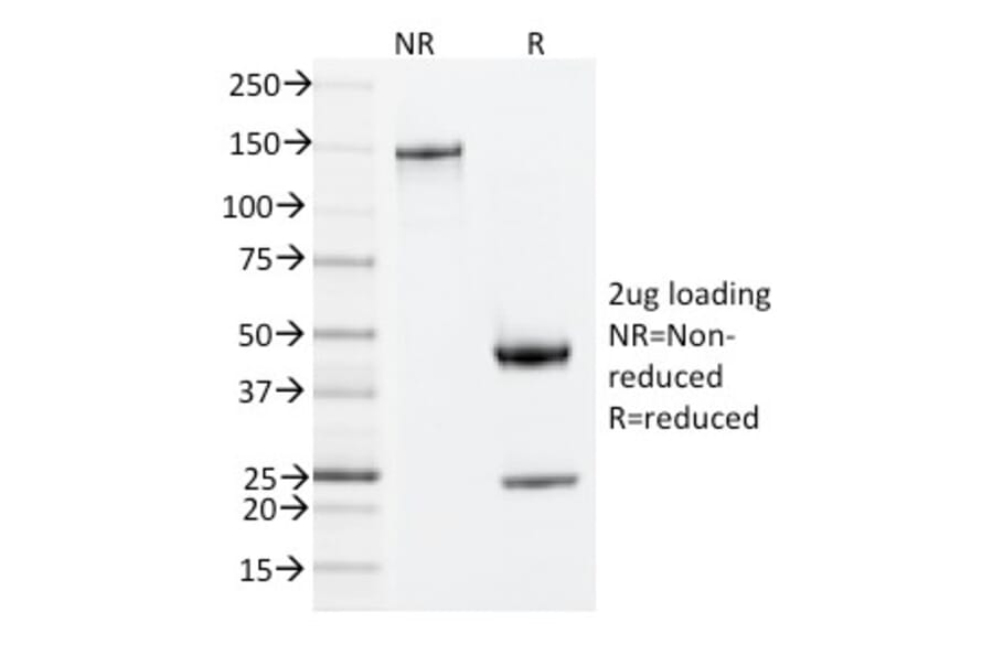 SDS-PAGE - Anti-ZAP70 Antibody [ZAP70/2035] (A250344) - Antibodies.com