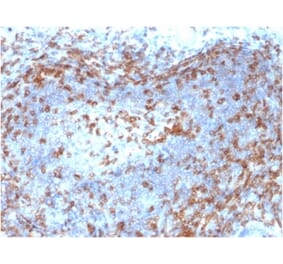Immunohistochemistry - Anti-ZAP70 Antibody [ZAP70/2046] (A250345) - Antibodies.com