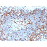 Immunohistochemistry - Anti-ZAP70 Antibody [ZAP70/2046] (A250345) - Antibodies.com