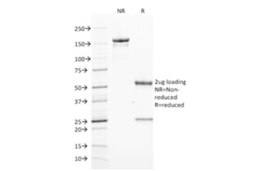 SDS-PAGE - Anti-ZAP70 Antibody [ZAP70/2046] (A250345) - Antibodies.com
