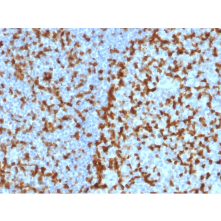 Immunohistochemistry - Anti-ZAP70 Antibody [ZAP70/2047] (A250346) - Antibodies.com