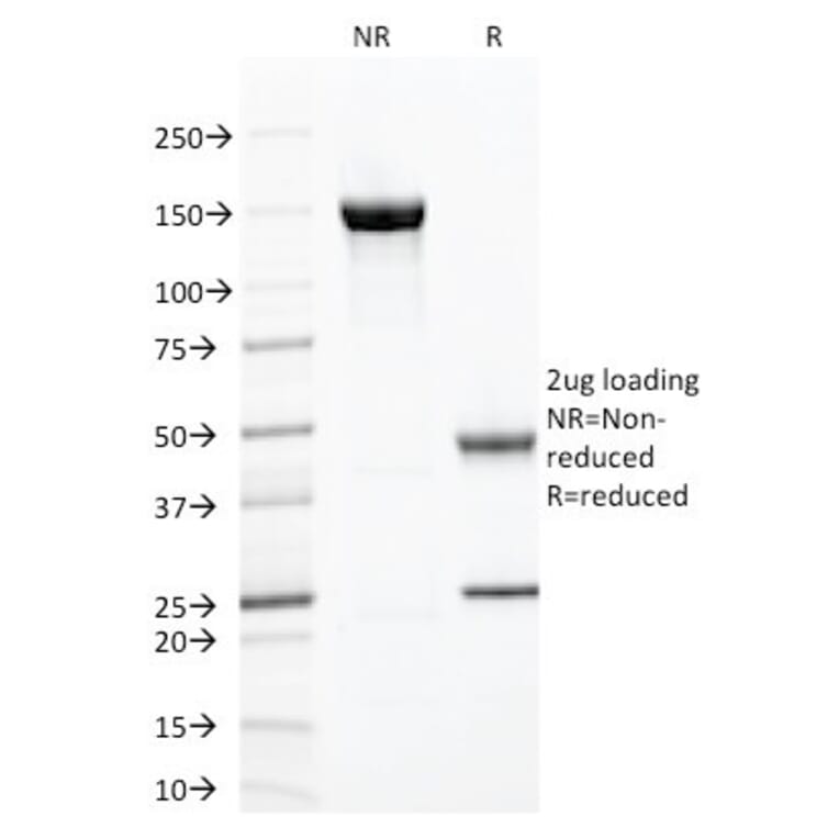 SDS-PAGE - Anti-ZAP70 Antibody [ZAP70/2047] (A250346) - Antibodies.com