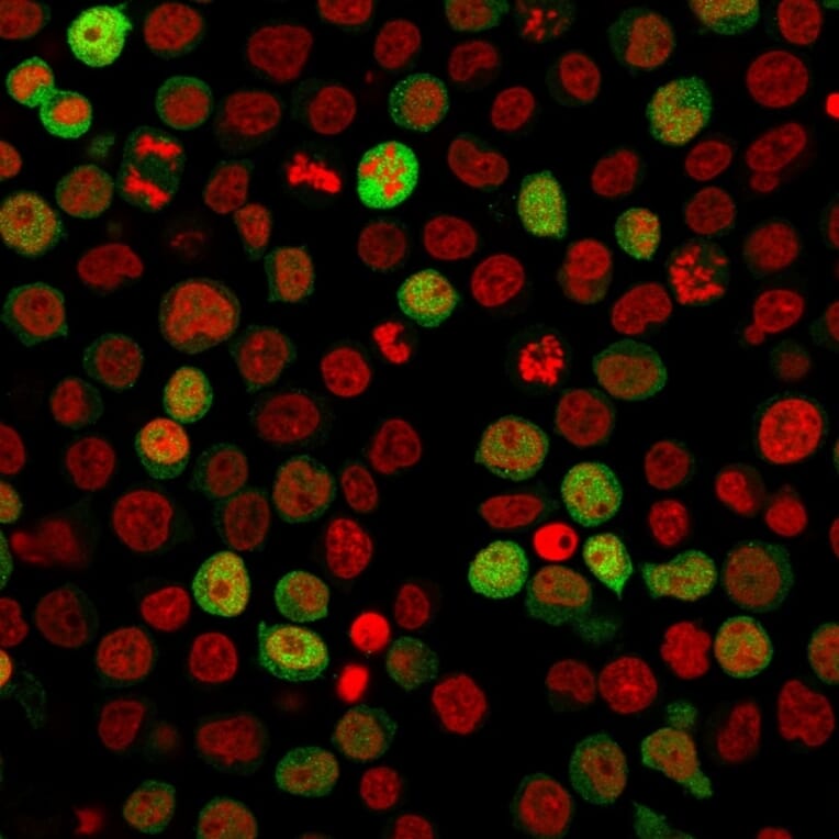 Immunofluorescence - Anti-ZAP70 Antibody [ZAP70/2047] (A250346) - Antibodies.com