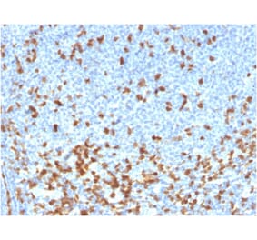 Immunohistochemistry - Anti-ZAP70 Antibody [rZAP70/2046] (A250346) - Antibodies.com