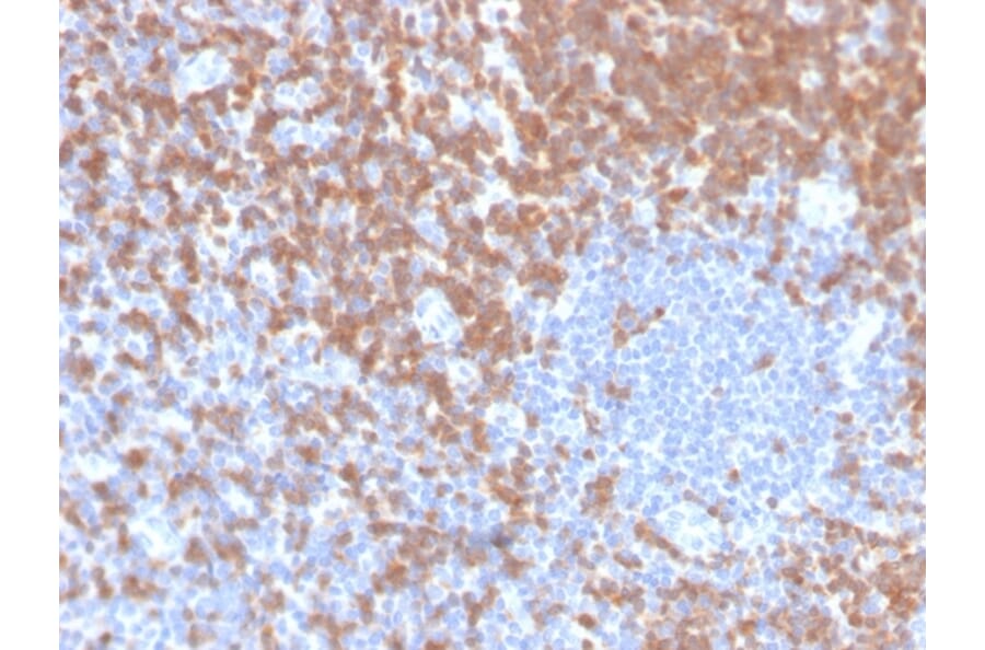 Immunohistochemistry - Anti-ZAP70 Antibody [ZAP70/4040R] (A250348) - Antibodies.com